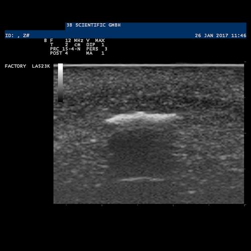 SONOtrain Modelo de corpos estranhos / Simulador para treinamento de identificação Guiada por Ultrasom, 1019636 [P121], Ultrasound Skill Trainers