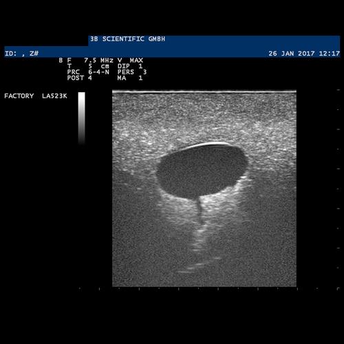 낭종이 있는 유방모형 SONOtrain Breast model with cysts, 1019634 [P124], 초음파 기술 트레이너