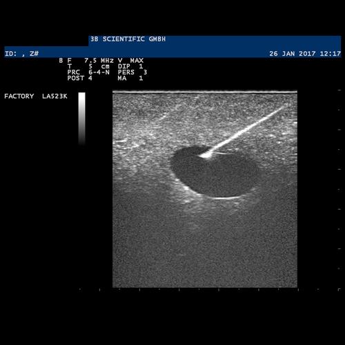 SONOtrain&nbsp;Breast Model with Cysts, Light Skin, 1019634 [P124], Ultrasound Skill Trainers