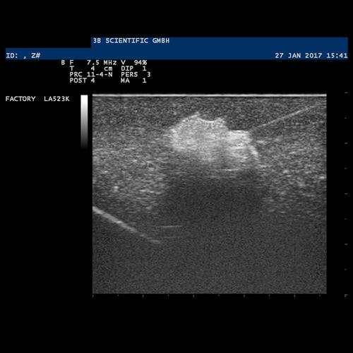SONOtrain Breast Model with Cysts, Dark Skin, 1024722 [P124D], Ultrasound Skill Trainers