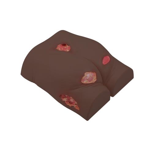 Entrenador de tratamiento de &uacute;lceras por presi&oacute;n, tono de piel oscuro, 1023319 [P15D], Cuidado dec&uacute;bito