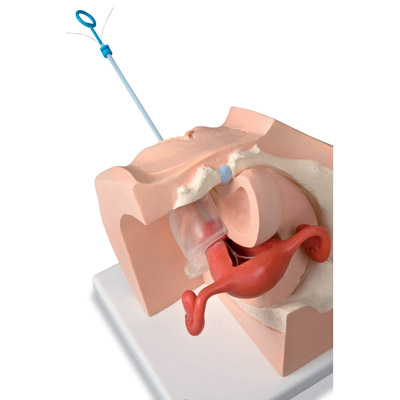 Modello ginecologico per colloquio con i pazienti - 3B Smart Anatomy, 1013705 [P53], Ostetricia