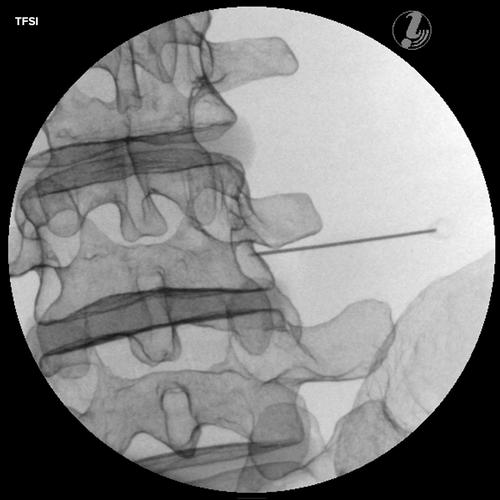 이미지 유도 요추 주사 트레이너 Image Guided Lumbar Spinal Injection Trainer P65, 1021898 [P65], 주사실습 및 천자
