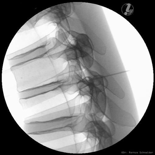 이미지 유도 흉추 주사 트레이너 Image Guided Thoracic Spinal Injection Trainer P66, 1021899 [P66], 주사실습 및 천자