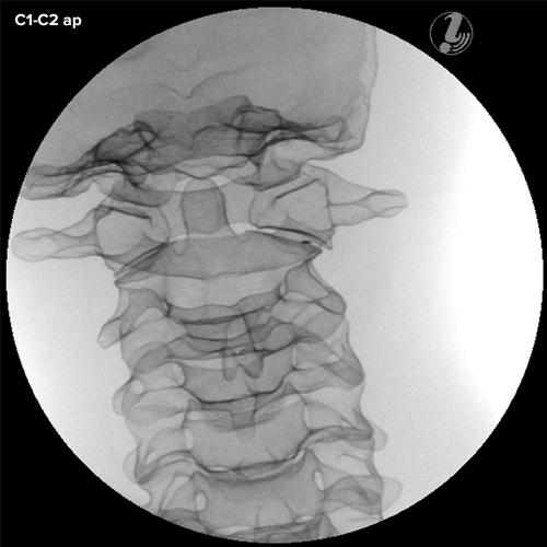 이미지 유도 경추 주사 트레이너 Image Guided Cervical Spine Injection Trainer P67, 1021900 [P67], 주사실습 및 천자