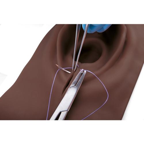 Simulateur d’incision du périnée et de sutures, teint foncé, 1023329 [P95D], Sutures et bandages