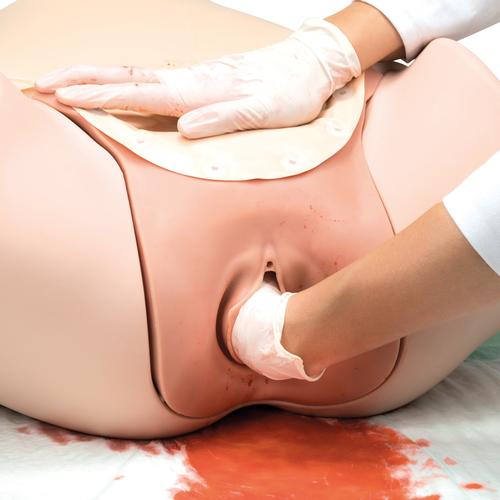 SIMULADOR DE HEMORRAGIA P&Oacute;S-PARTO P97, 1021568 [P97], Obstetr&iacute;cia