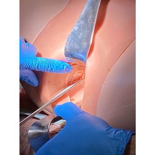 Postpartum Hemorrhage Simulator – PPH Trainer P97 PRO, 1023727 [P97P], Obstetrics