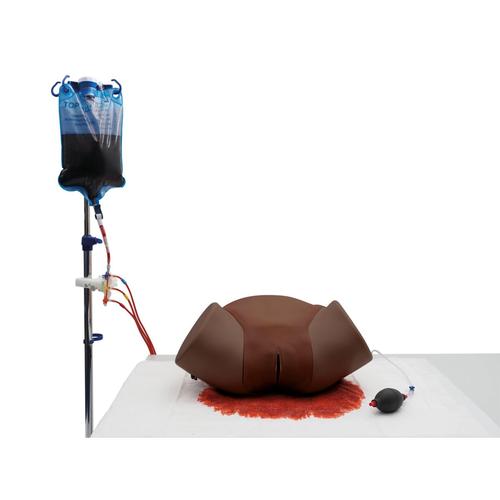 SIMULADOR DE HEMORRAGIA P&Oacute;S-PARTO P97D PRO&nbsp;pele escura, 1023975 [P97PD], Obstetr&iacute;cia