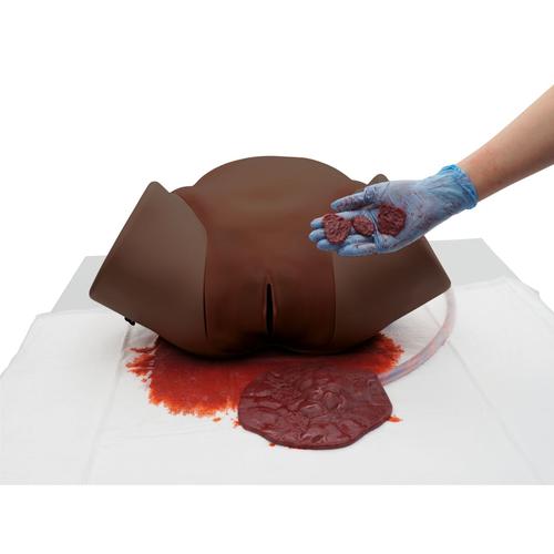 Simulador de hemorragia posparto &ndash; Entrenador para HPP P97D PRO&nbsp;tono de piel oscuro, 1023975 [P97PD], Obstetricia