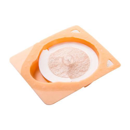 SEIRIN ® New PYONEX - 0,11 x 0,30 mm, arancione, scatole da 100 aghi., 1002468 [S-PO], Aghi per agopuntura SEIRIN