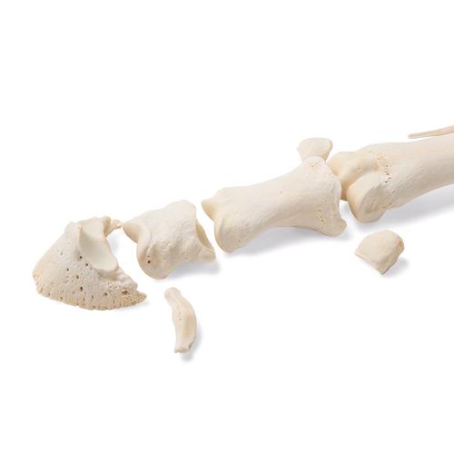 Cavallo metatarso, 1021068 [T30069], osteologia