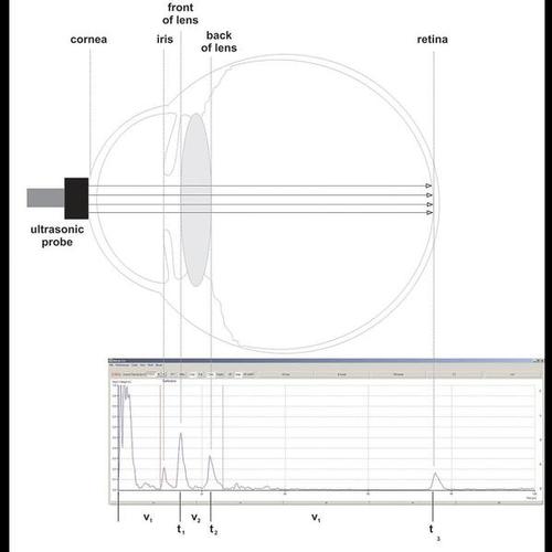 Mod&egrave;le d'&oelig;il pour biom&eacute;trie par ultrasons, 1012869 [U10018], Composants Biom&eacute;trie