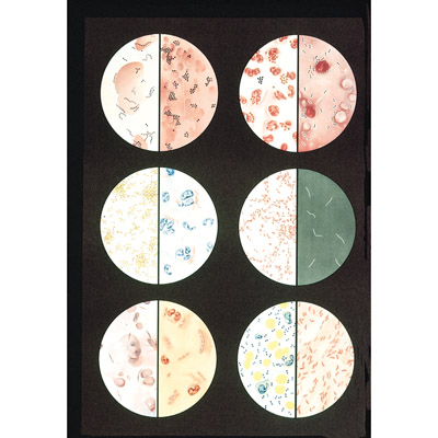 Bacteria Chart - 1001194 - V2041M - Parasitic, Viral or Bacterial Infection  - 3B Scientific
