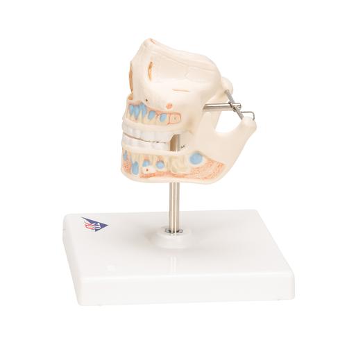 乳牙模型 - 3B Smart Anatomy, 1001248 [VE282], 牙齿模型