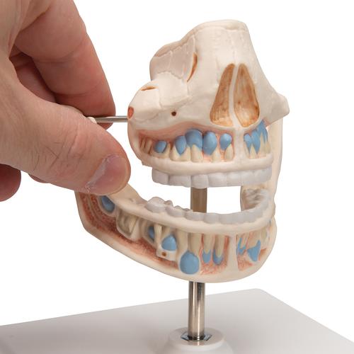 어린이 치열 모형 Milk Dentures - 3B Smart Anatomy, 1001248 [VE282], 치아 모형