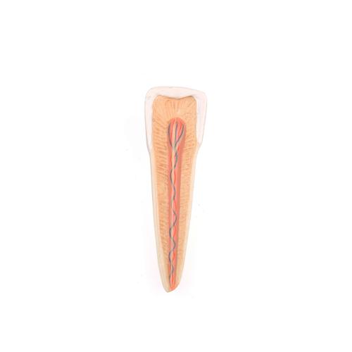 Усовершенствованная модель половины нижней челюсти с 8 больными зубами, 19 частей - 3B Smart Anatomy, 1001250 [VE290], Модели зубов