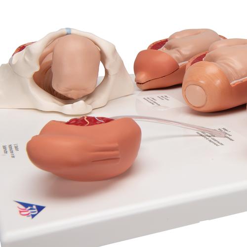 Les différents stades de l'accouchement - 3B Smart Anatomy, 1001259 [VG393], Modèles de grossesse
