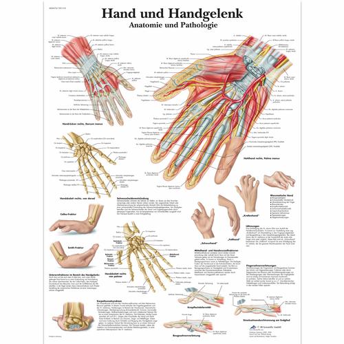 Lehrtafel - Hand und Handgelenk - Anatomie und Pathologie, 4006576 [VR0171UU], Skelettsystem