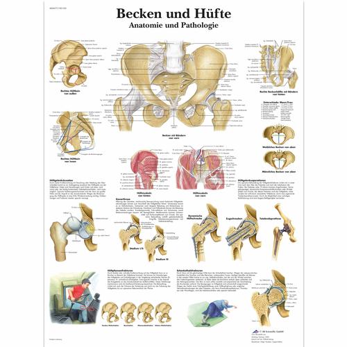 Lehrtafel - Becken und Hüfte - Anatomie und Pathologie, 1001320 [VR0172L], Skelettsystem