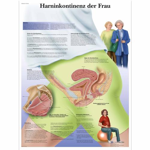Harninkontinenz der Frau, 4006620 [VR0542UU], Ginecología
