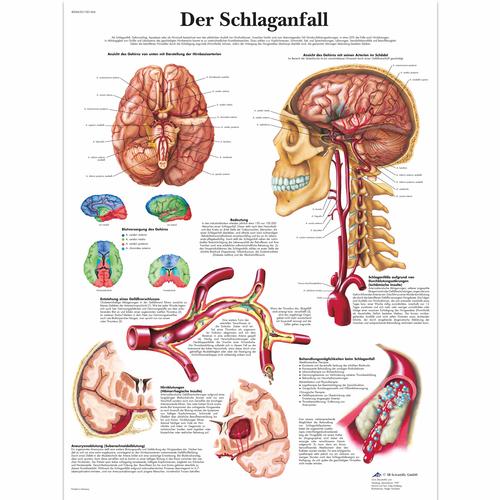 Der Schlaganfall, 4006630 [VR0627UU], 心血管系统