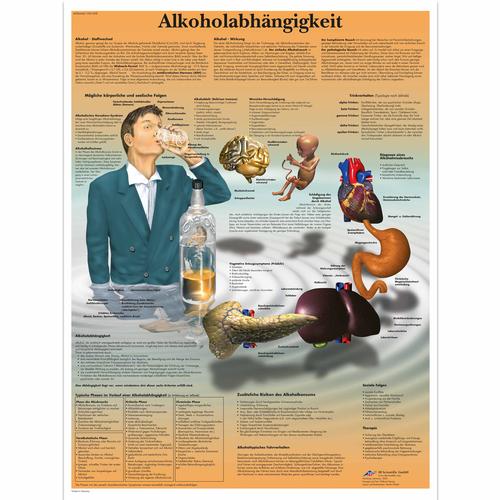 Lehrtafel - Alkoholabh&auml;ngigkeit, 4006646 [VR0792UU], Sucht