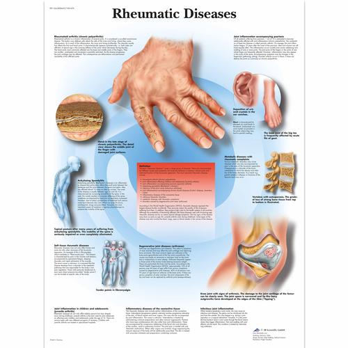 Rheumatic Diseases, 1001476 [VR1124L], 骨骼系统