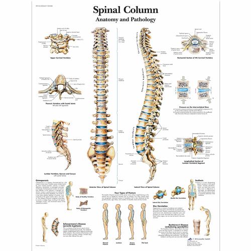 Lehrtafel - Spinal Column - Anatomy and Pathology, 1001480 [VR1152L], Skelettsystem