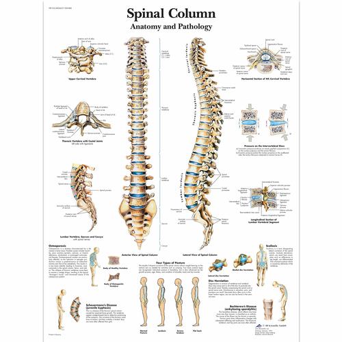 Lehrtafel&nbsp;- Spinal Column - Anatomy and Pathology, 1001480 [VR1152L], Skelettsystem