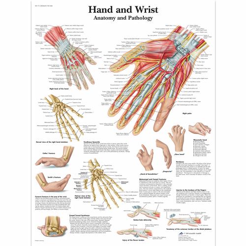 Lehrtafel - Hand and Wrist - Anatomy and Pathology, 1001484 [VR1171L], Skelettsystem