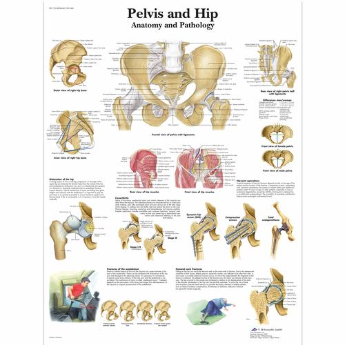 Lehrtafel - Pelvis and Hip - Anatomy and Pathology, 1001486 [VR1172L], Skelettsystem