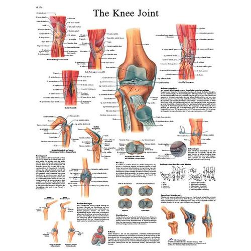 Knee Joint STICKYchart™, VR1174S, Sistema Esquelético