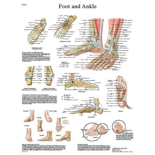 Foot and Ankle STICKYchart™, VR1176S, Sistema Esquelético