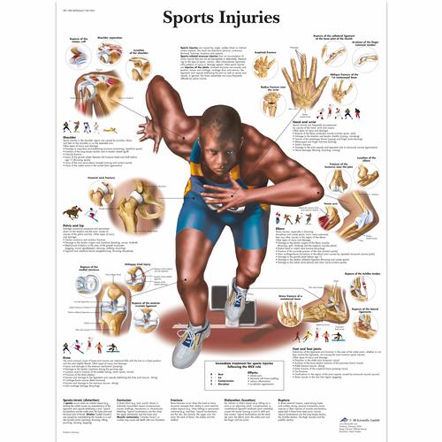 Lehrtafel - Sports Injuries, 1001494 [VR1188L], Muskel
