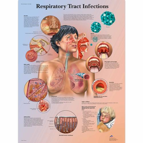 Respiratory Tract Infections Chart, 4006671 [VR1253UU], Respiratory System