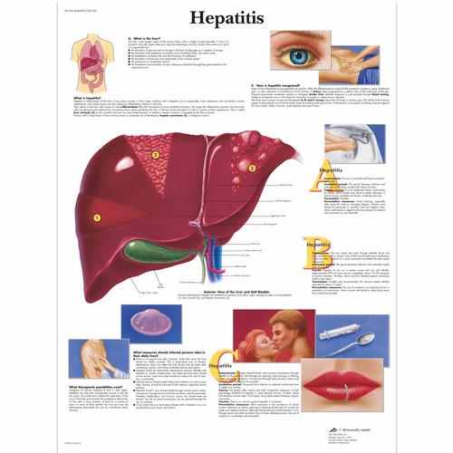 Hepatitis Chart, 1001552 [VR1435L], Metabolic System