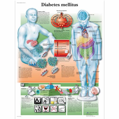 Diabetes Mellitus Chart, 1001554 [VR1441L], Metabolic System