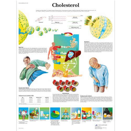 Cholesterol Chart, 1001558 [VR1452L], Cardiovascular System