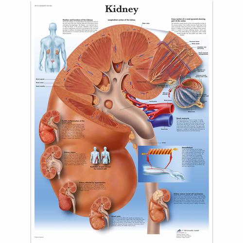 Kidney Chart, 4006699 [VR1515UU], Metabolic System
