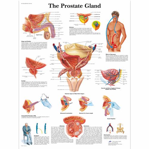 The Prostate Gland Chart, 1001566 [VR1528L], Men's Health Education