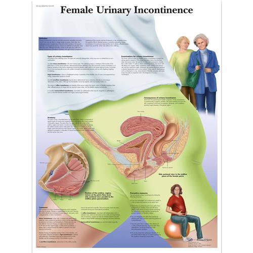Female Urinary Incontinence Chart, 4006702 [VR1542UU], Gynaecology
