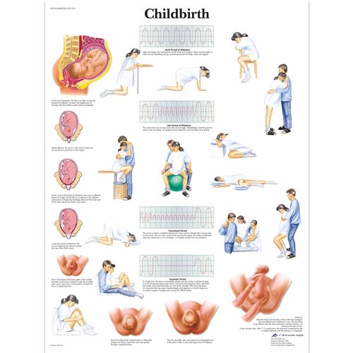 Lehrtafel - Childbirth, 4006704 [VR1555UU], Schwangerschaft und Geburt
