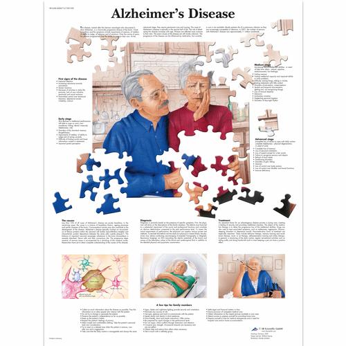 Alzheimer's Disease Chart, 1001592 [VR1628L], Brain and Nervous system