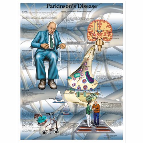 Parkinson's Disease, 4006714 [VR1629UU], Cerebro y sistema nervioso