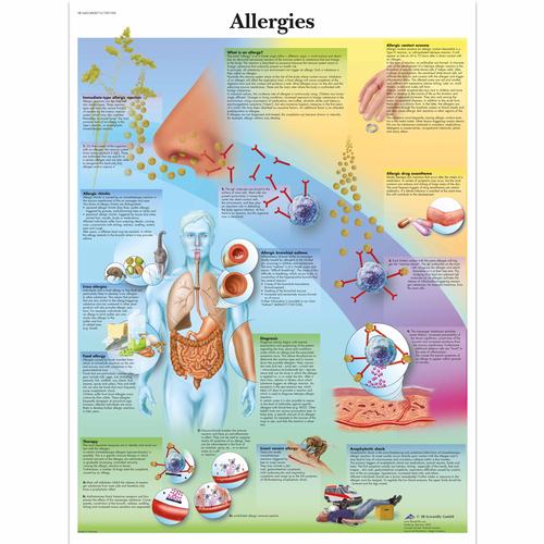 Allergies, 1001596 [VR1660L], Strumenti didattici su asma e allergie