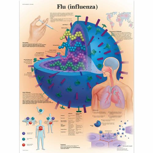 感冒(流感)挂图, 1001608 [VR1722L], 寄生虫、病毒、细菌感染