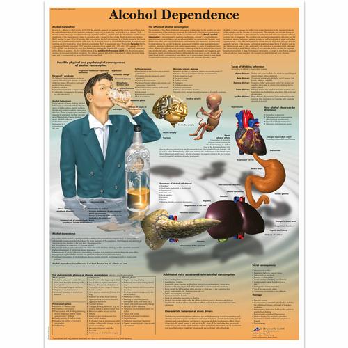 酒精依赖展示挂图, 1001620 [VR1792L], 药物滥用和酒精滥用教育训练模型