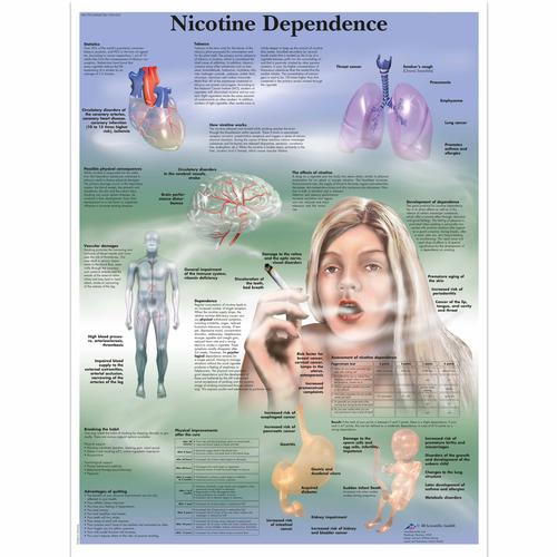 Nicotine Dependence Chart, 1001622 [VR1793L], Tobacco Education