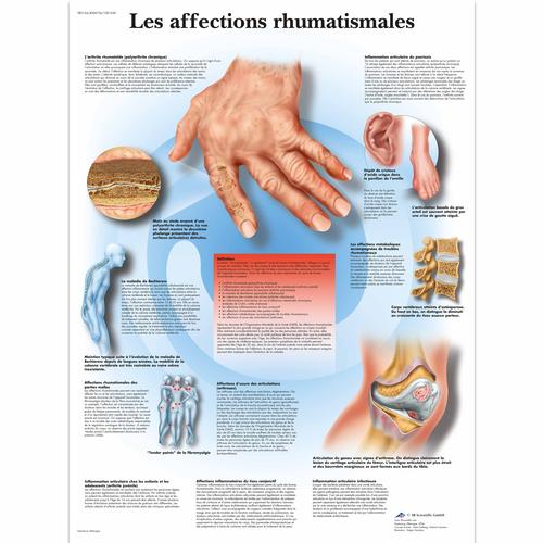 Les affections rhumatismales, 4006736 [VR2124UU], Skeletal System
